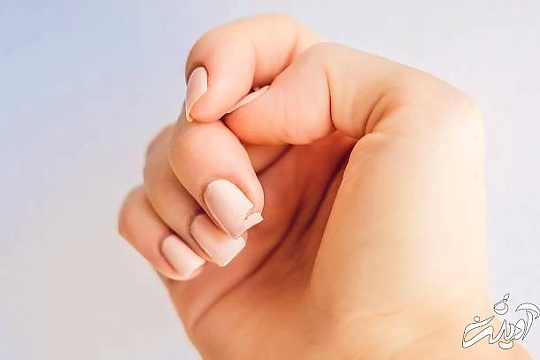 ترک خوردن ناخن کاشت